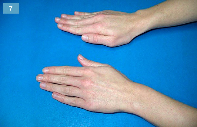 Ćwiczenie wyprostu palców