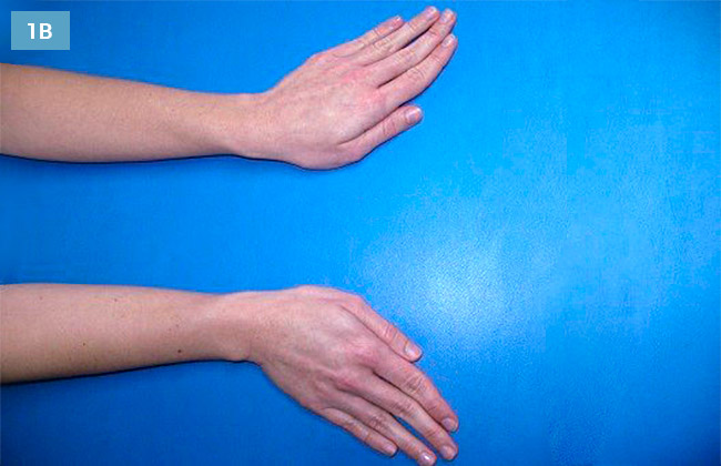 Ćwiczenie odwodzenie łokciowe i promieniowe ręki