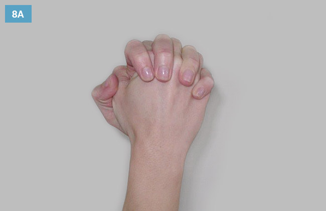 Ćwiczenie zgięcia splecionych nagrastków