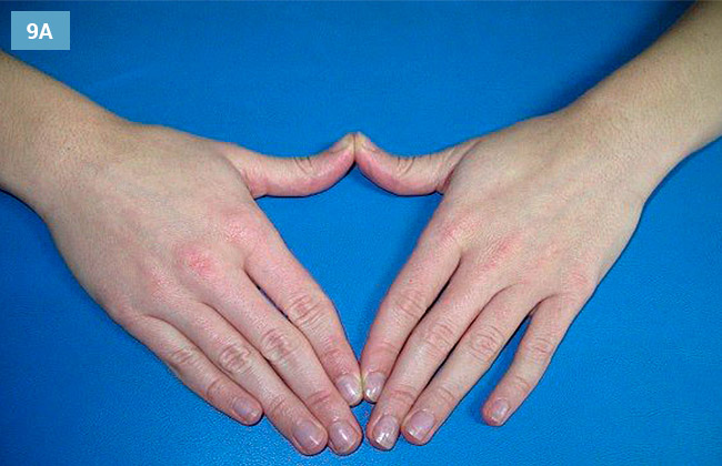 Ćwiczenie rozciągania przyśrodkowych części rąk